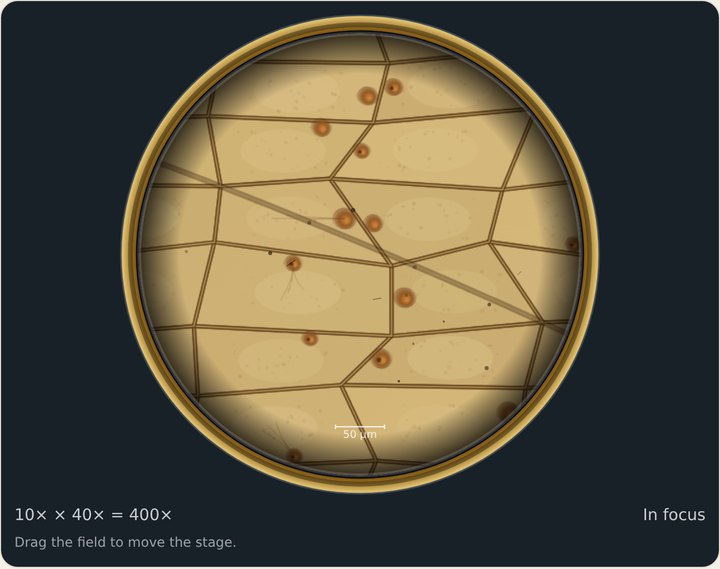 Onion cells stained with iodine; brown nuclei.