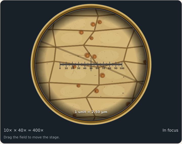 The ruler across onion cells.